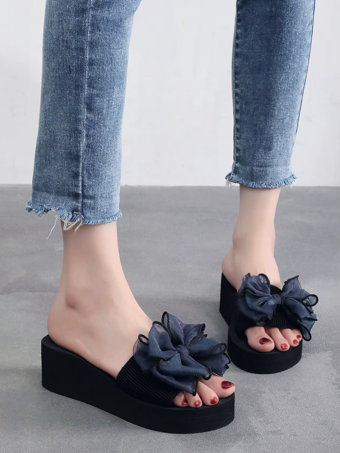 Mireia® - Orthopaedic Sandals | Premium Edition